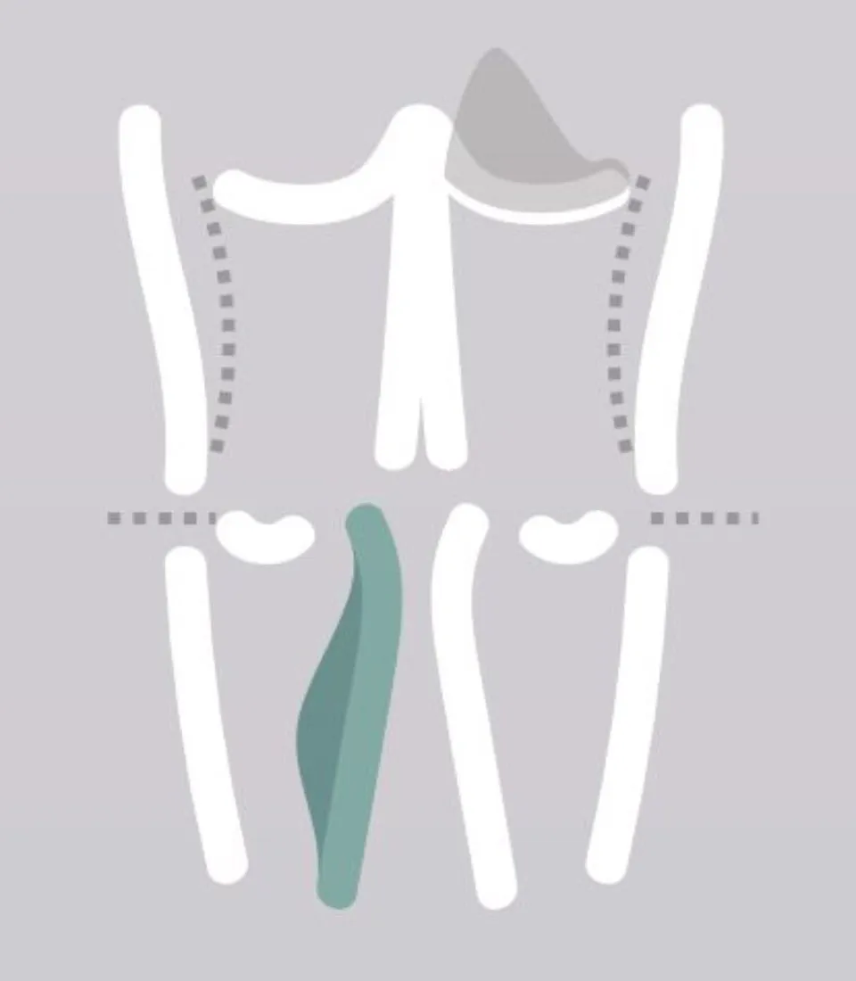 chirurgia estetica arti
