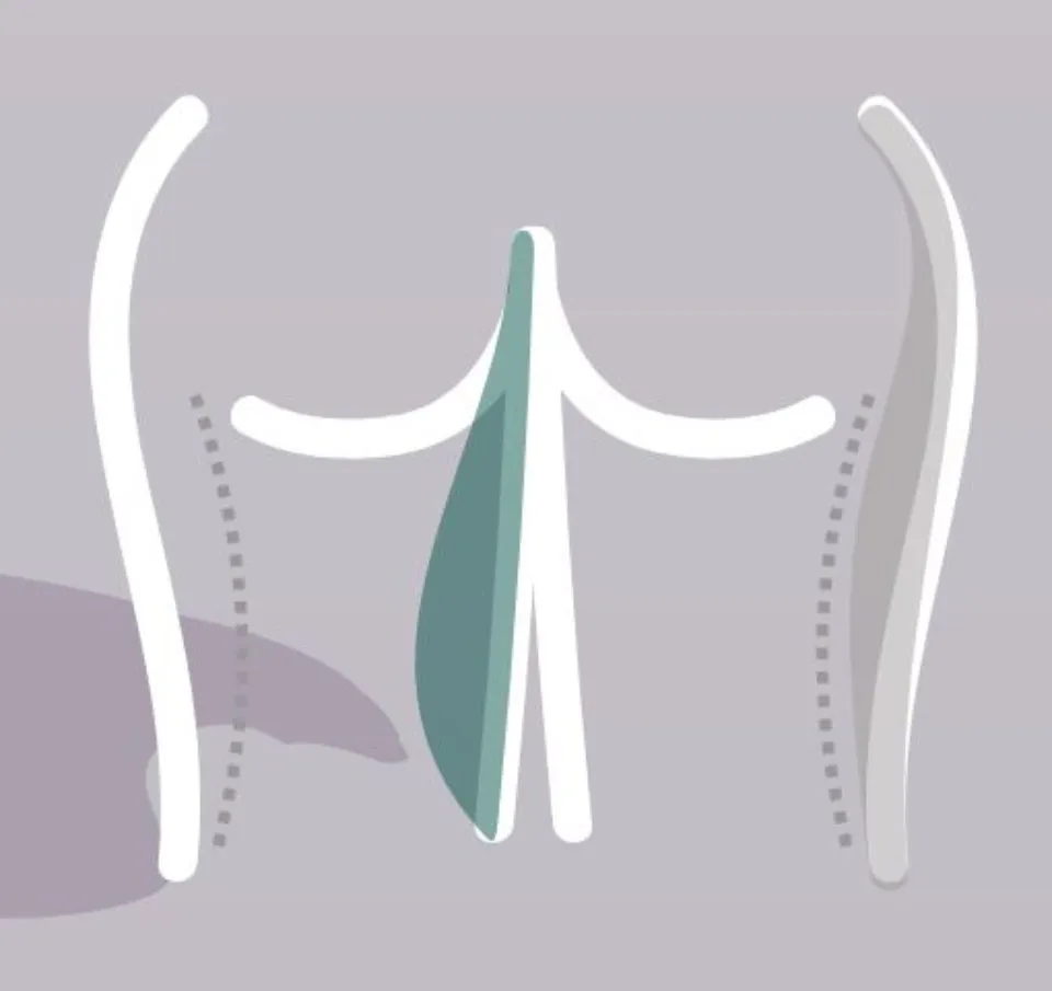 rimodellamento glutei