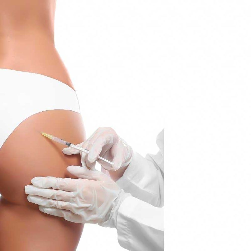 rimodellamento glutei